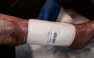 maintain moist wound environment